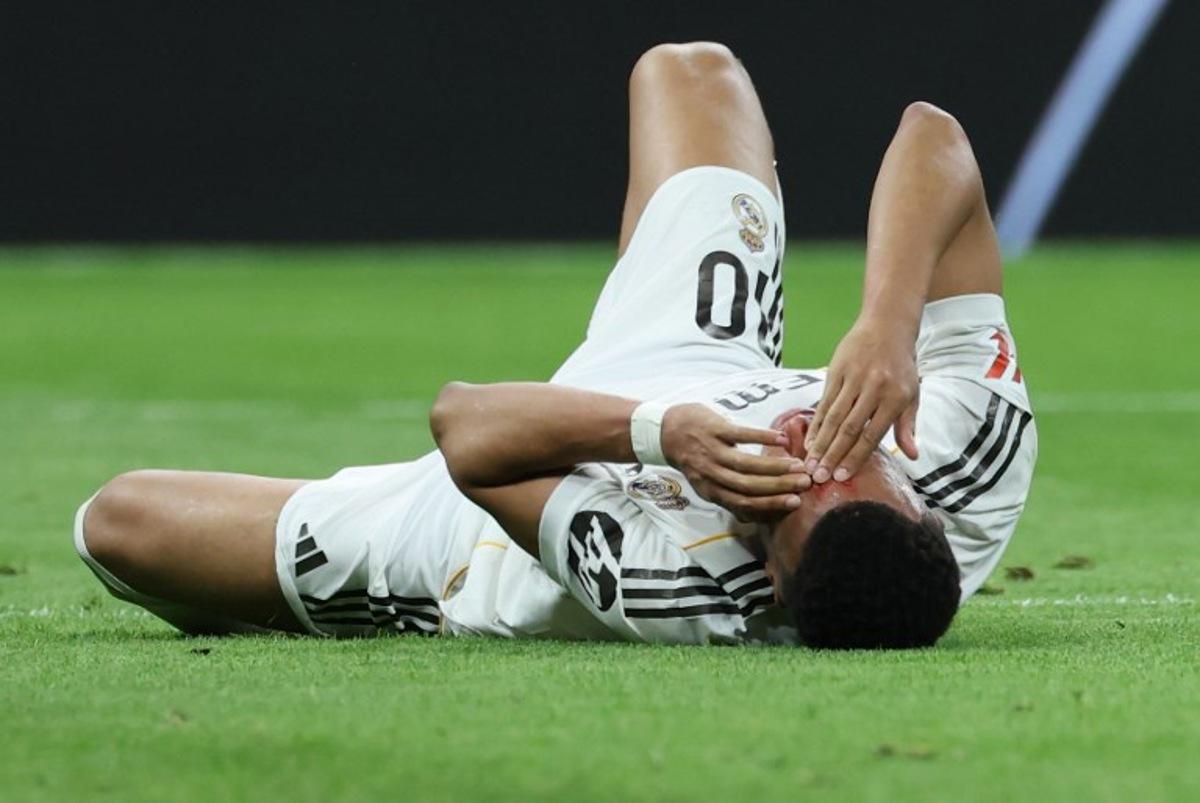 Real Madrid's French forward #10 Kylian Mbappe lies on the pitch with blood on his face after colliding with Girona's Brazilian defender #12 Vitor Reis (not pictured) during the Spanish league football match between Real Madrid CF and Girona FC at the Santiago Bernabeu stadium in Madrid on April 10, 2026.  Thomas COEX / AFP