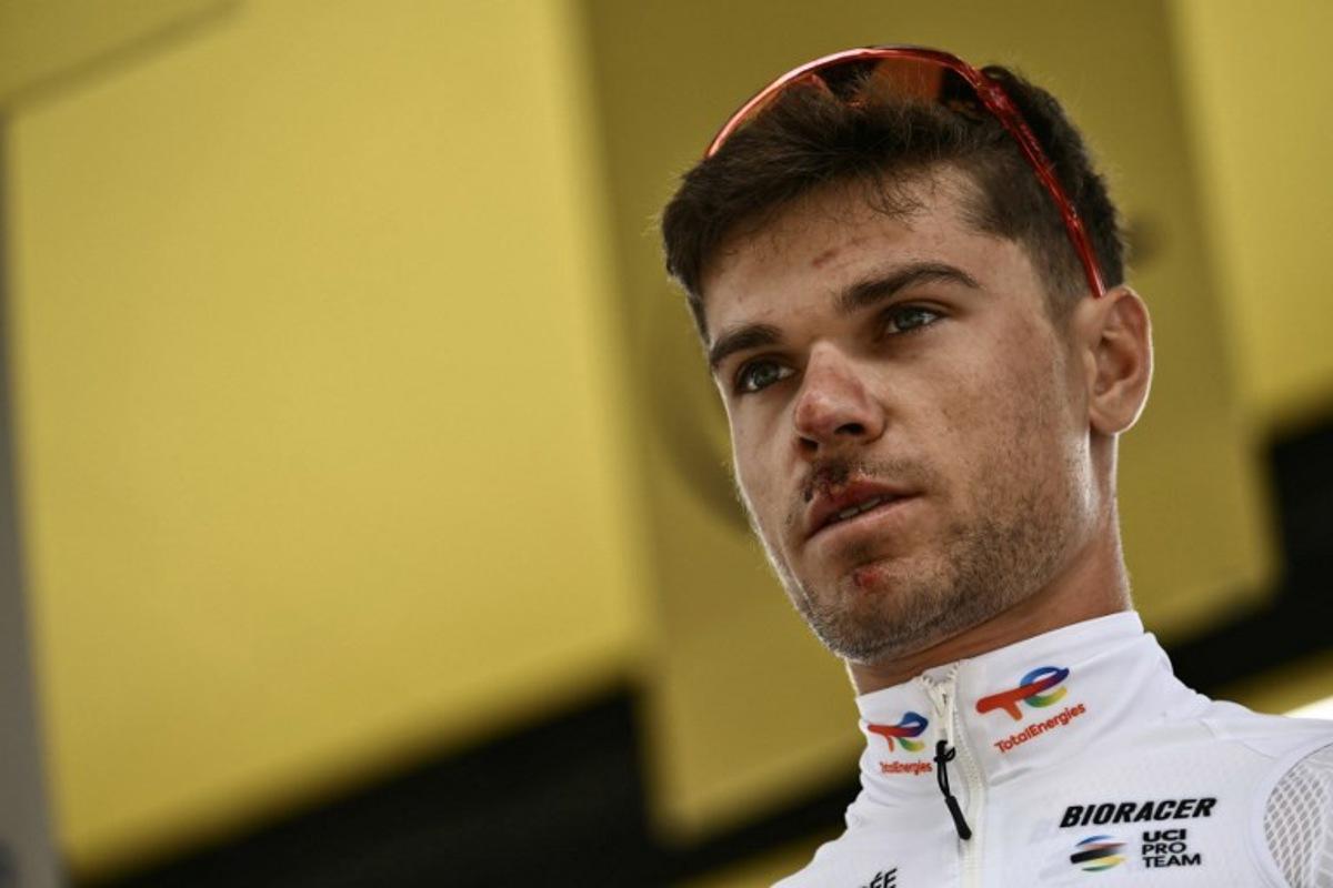 Team TotalEnergies' French rider Emilien Jeanniere looks on, with visible injuries on his face after his crash one day prior, at the start of the 4th stage of the 112th edition of the Tour de France cycling race, 174.2 km between Amiens Metropole and Rouen, Northern France, on July 8, 2025. Marco BERTORELLO / AFP