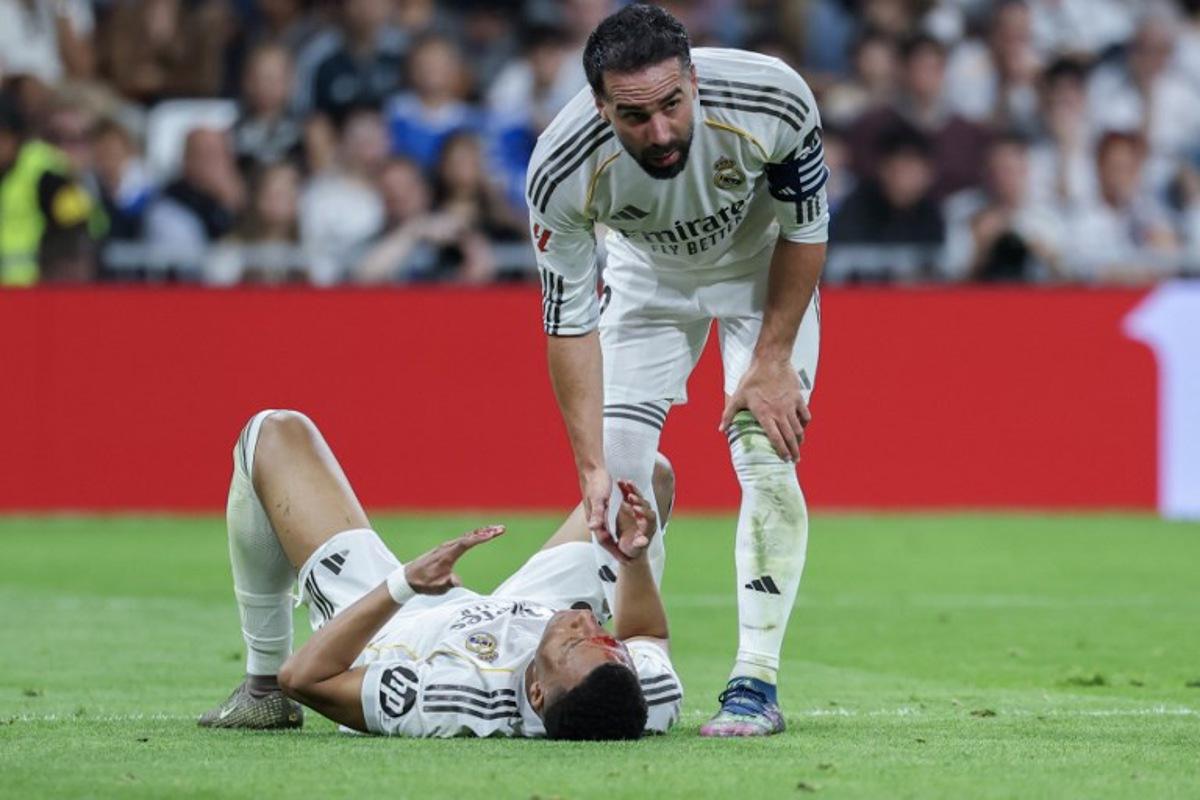 Real Madrid's French forward #10 Kylian Mbappe (L) lies on the pitch with blood on his face after colliding with Girona's Brazilian defender #12 Vitor Reis (not pictured) as Real Madrid's Spanish defender #02 Dani Carvajal assists during the Spanish league football match between Real Madrid CF and Girona FC at the Santiago Bernabeu stadium in Madrid on April 10, 2026. Thomas COEX / AFP