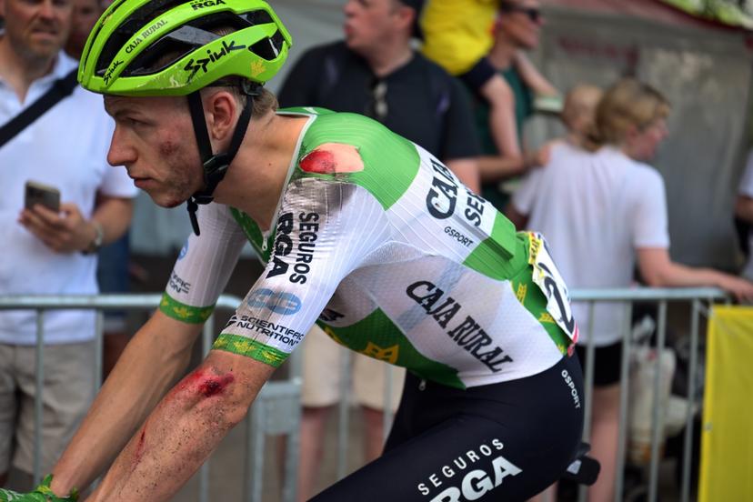 Dutch Alex Molenaar of Caja Rural-Seguros RGA is bruised after a fall at stage 5 of the 2026 Tour de France cycling race, a stage of 158km from Lannemezan to Pau, on Wednesday 08 July 2026. The 113th edition of the Tour de France starts on Saturday 4 July in Barcelona, Spain, and will finish in Paris, France on the 26th of July. BELGA PHOTO DAVID PINTENS